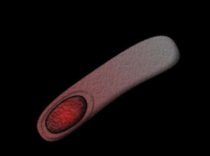 Schematisch: CLostridium Difficile bildet eine Endospore (rot)
