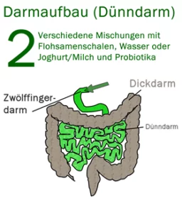 Darmaufbau Anleitung